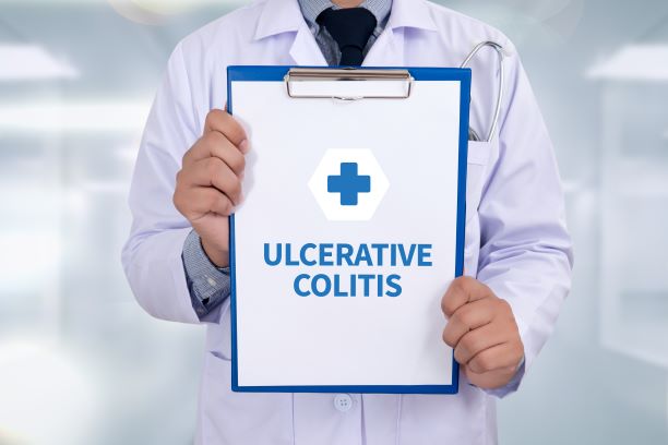 Ulcerative-Colitis-in-Adults