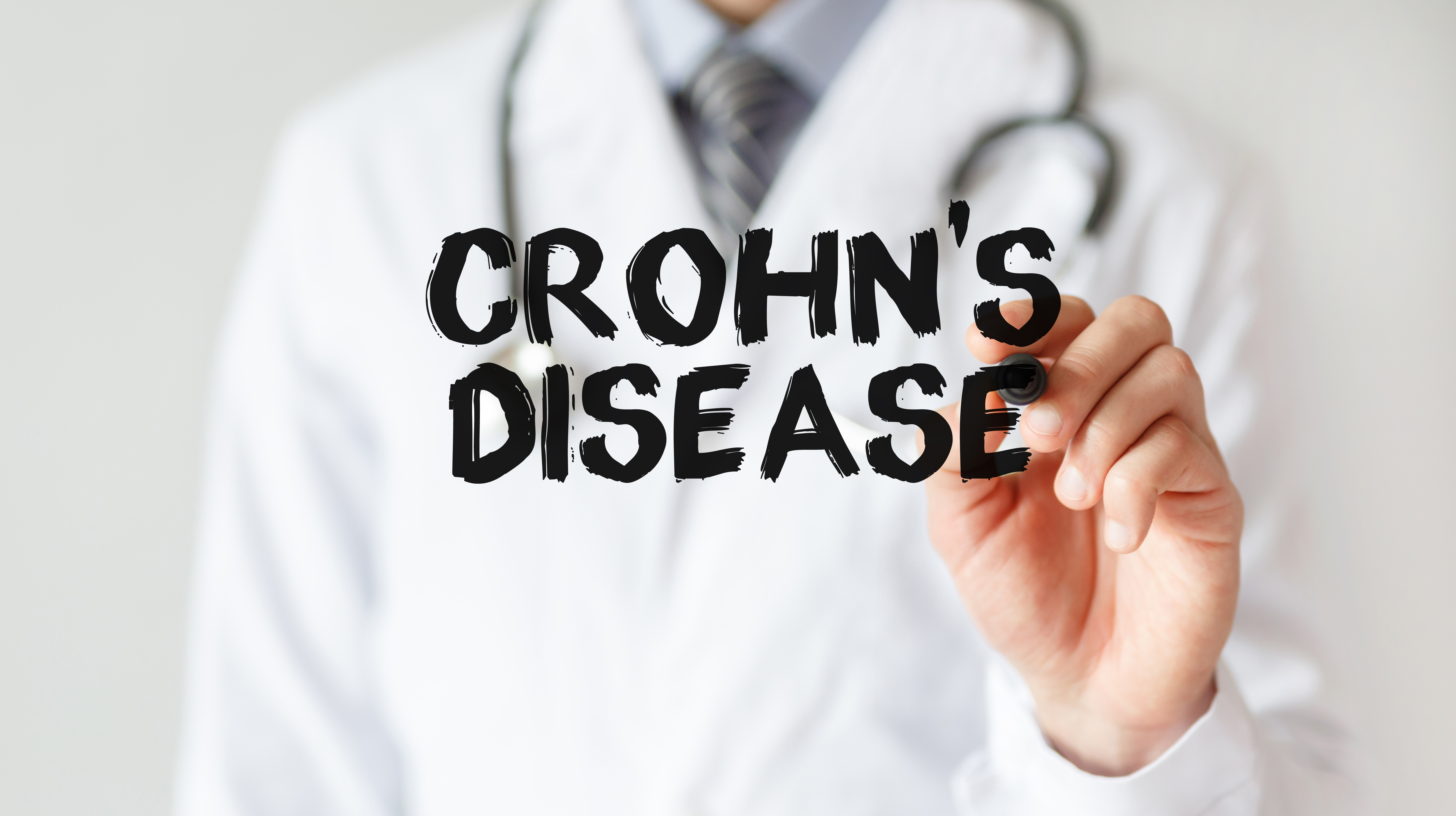 Crohn's Disease in Adults