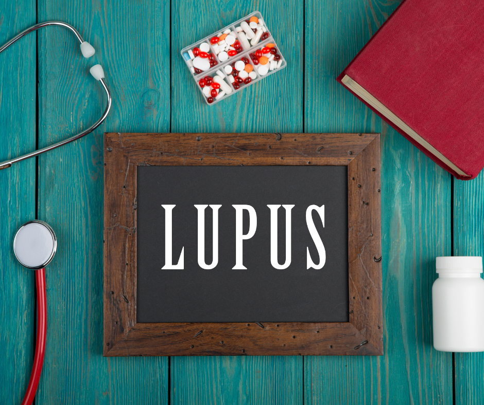 Systemic Lupus Erythematosus in Adults