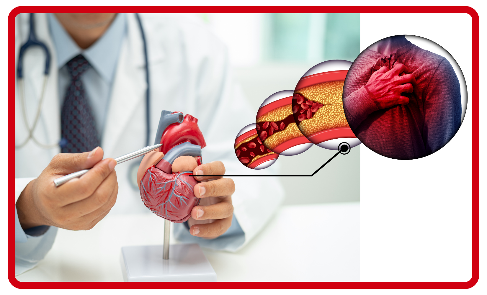 Dyslipidemia D7960C00015 landing page pic